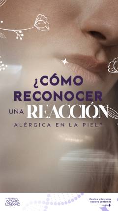 AO - Stories 16 - 01